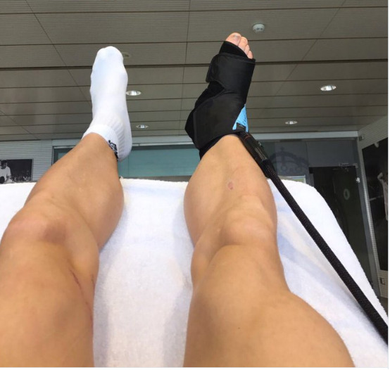 gareth-bale-injury-update-instagram