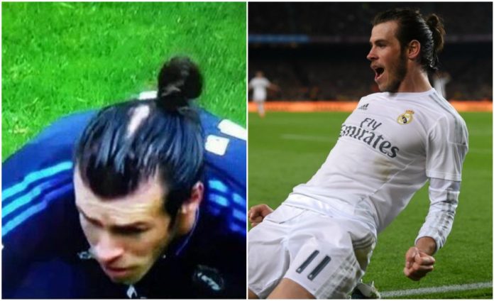 bale