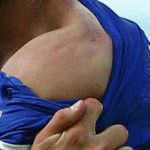 suarez 3