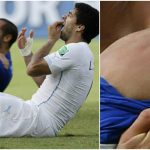 suarez bites
