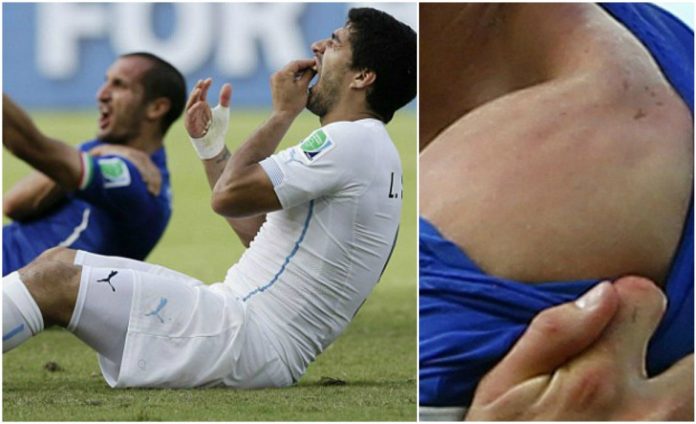 suarez bites